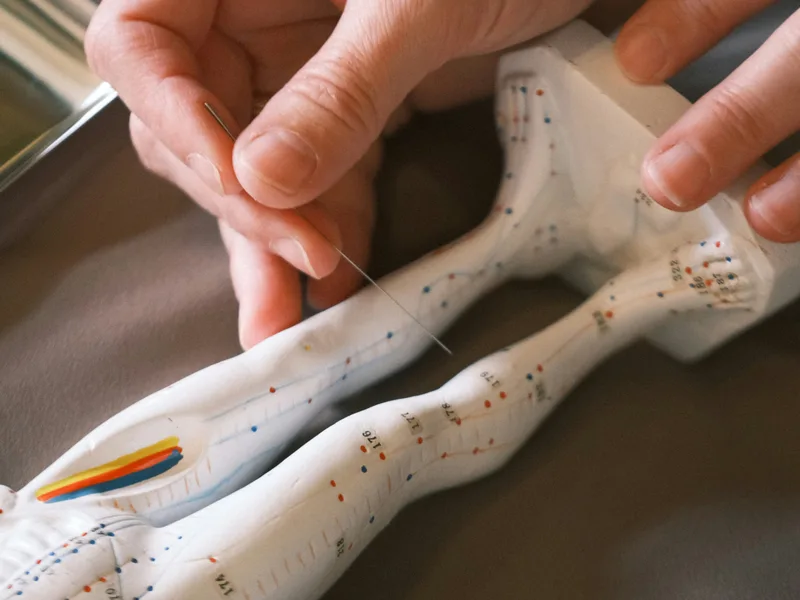 Acupuncture at Honolulu Pain Relief Center in Honolulu