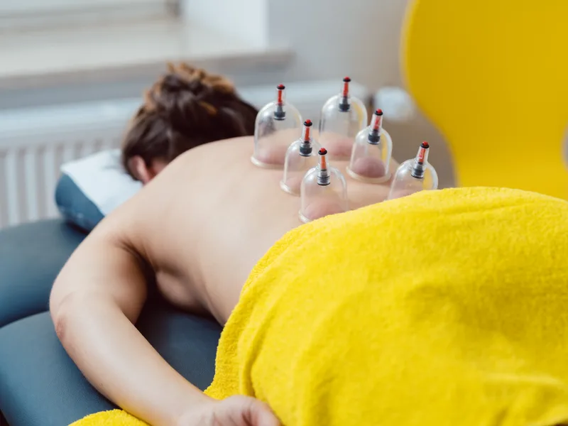 Cupping Therapy at Honolulu Pain Relief Center in Honolulu