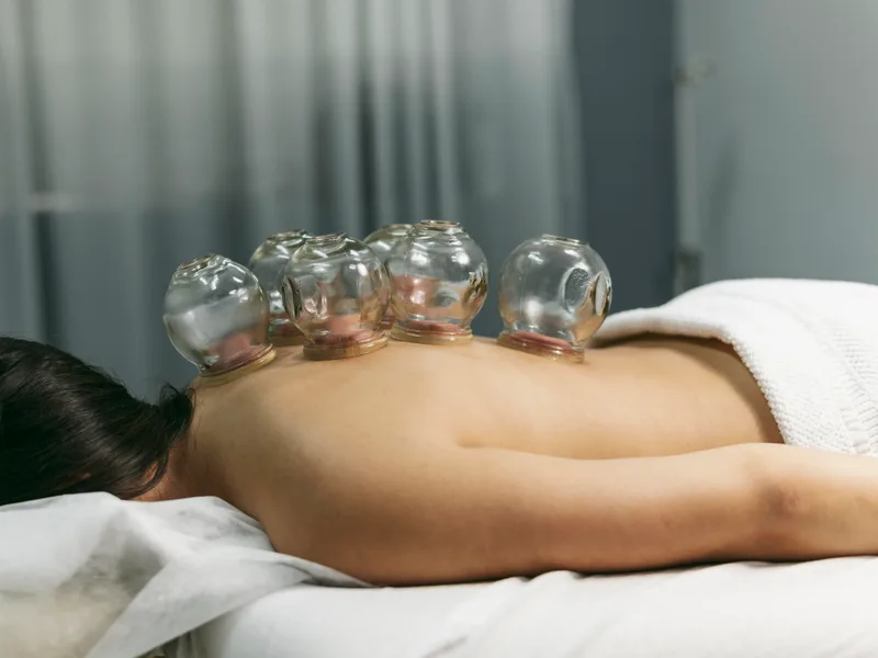 Cupping Therapy at Honolulu Pain Relief Center in Honolulu