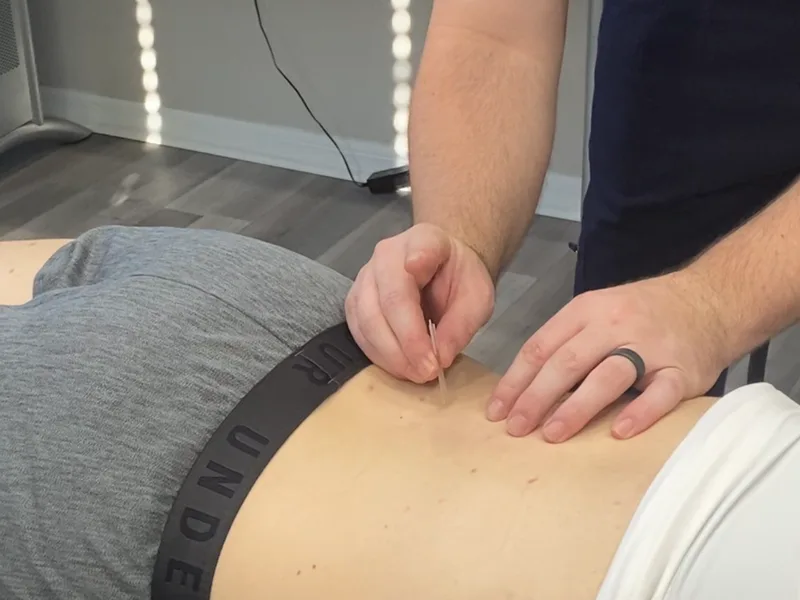 How Dry Needling works at Honolulu Pain Relief Center