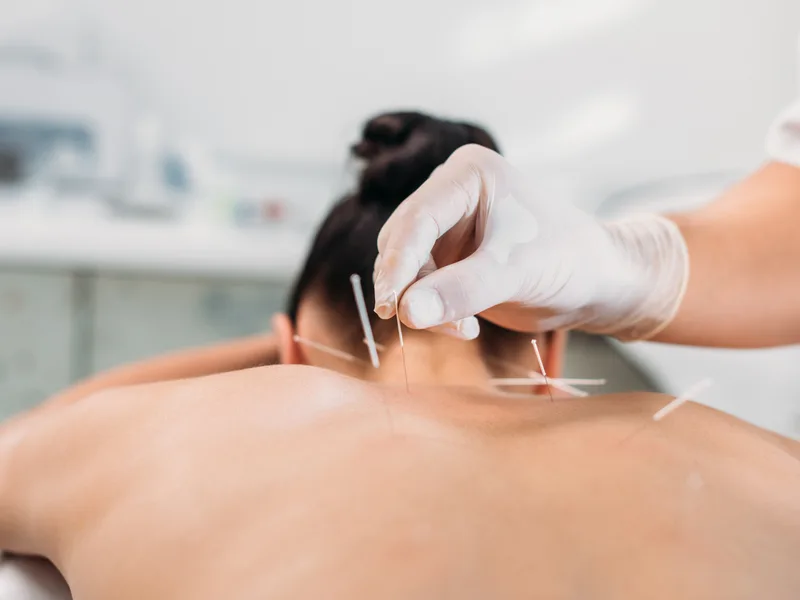 Dry Needling at Honolulu Pain Relief Center in Honolulu