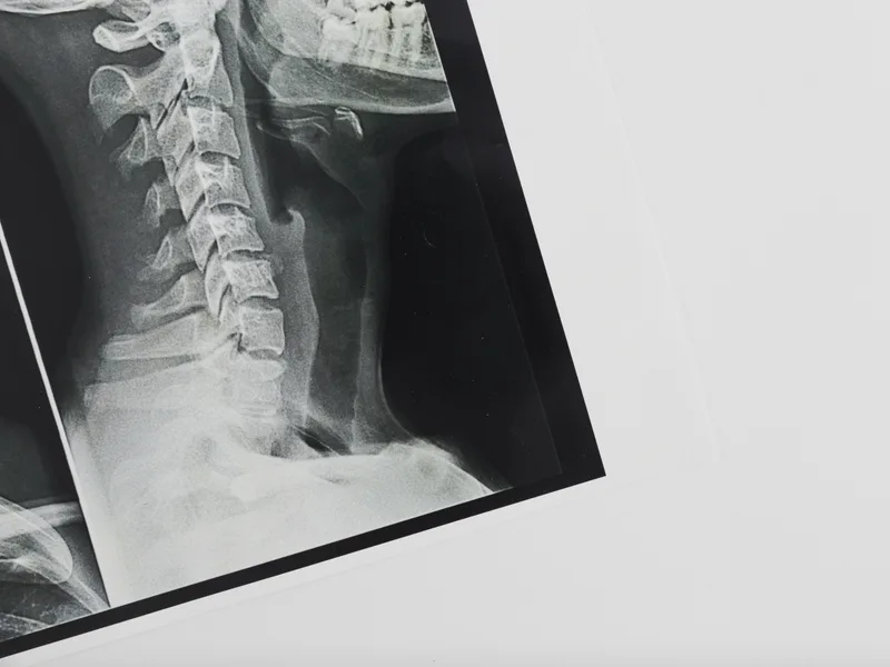 X-Rays at Honolulu Pain Relief Center in Honolulu